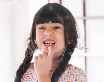 Common Dental Issues in Children and How to Prevent Them