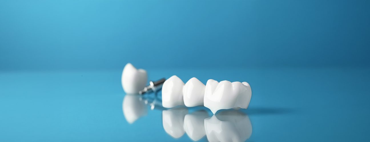 How to Alleviate Pain from a Temporary Crown Until Your Next Appointment