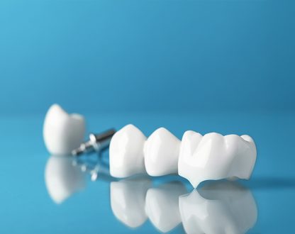 How to Alleviate Pain from a Temporary Crown Until Your Next Appointment